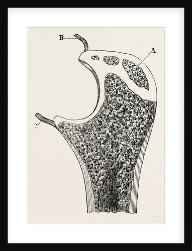 End of the ulna by Anonymous