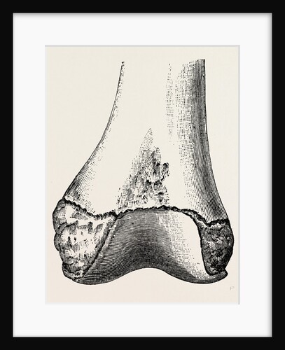 Epiphyses of the femur by Anonymous