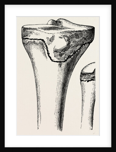 Epiphyses of the femur by Anonymous
