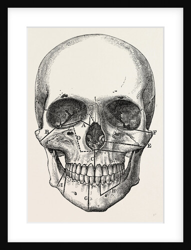 Incisions by Anonymous