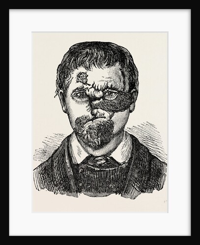 Aspect of patient by Anonymous