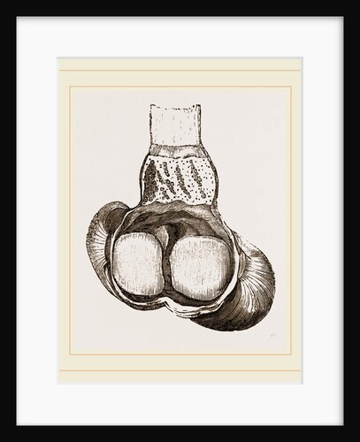 Gizzard of Swan by Anonymous