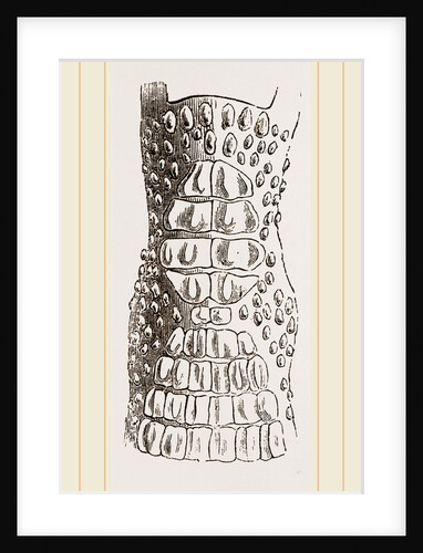 Cerviical Plates Jacare by Anonymous