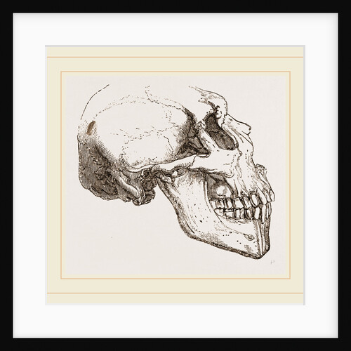 Skull of Human Idiot by Anonymous