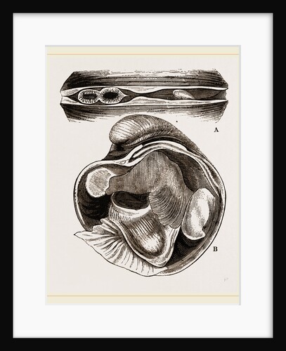 Heart Isocordia by Anonymous