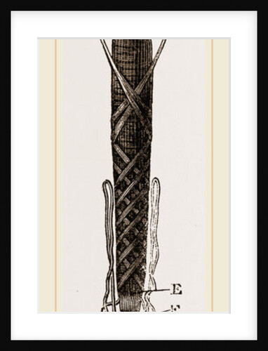 Viscera of Goat-Moth by Anonymous