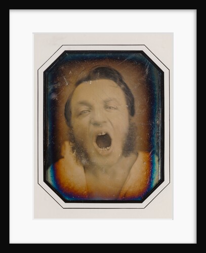 Man with Open Mouth by Anonymous