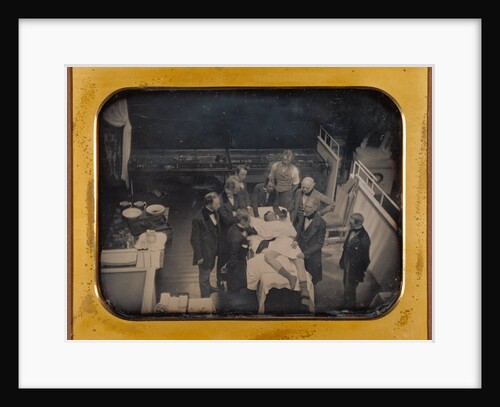 Early Operation Using Ether for Anesthesia by Southworth & Hawes