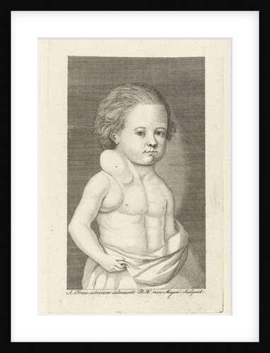 Boy with a tumor by Pieter Willem van Megen