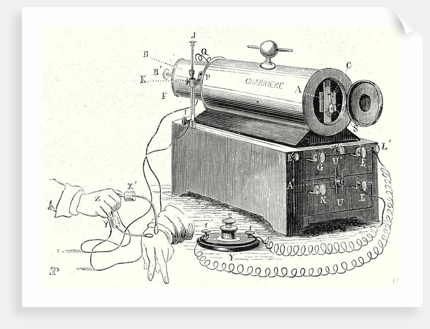 The Device of M. Duchenne (De Boulogne) by Anonymous
