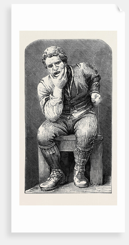 Toothache from a Figure in Stone by Mr. Anderson the Burns Centenary by Anonymous