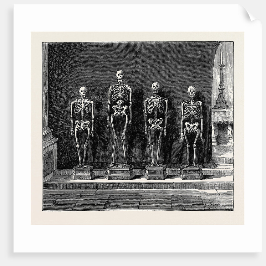 A Visit to the Battlefield of Solferino: Skeletons Found on the Battlefield by Anonymous