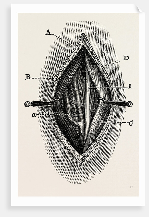 Ligature by Anonymous