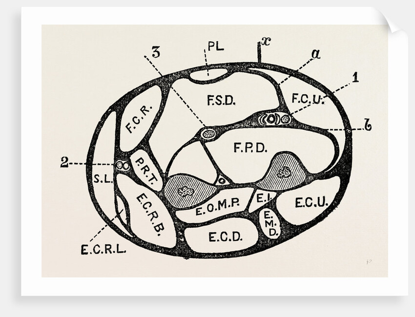 Section of the forearm by Anonymous