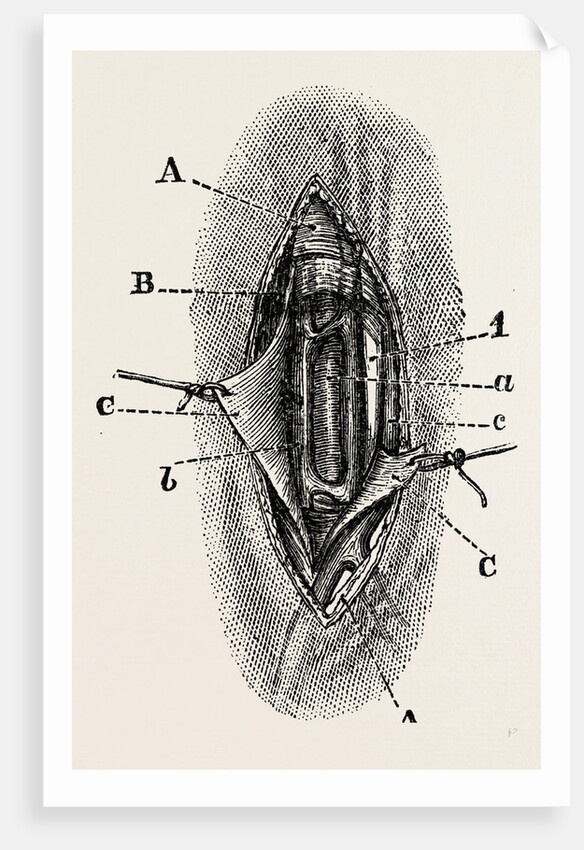 Ligature by Anonymous