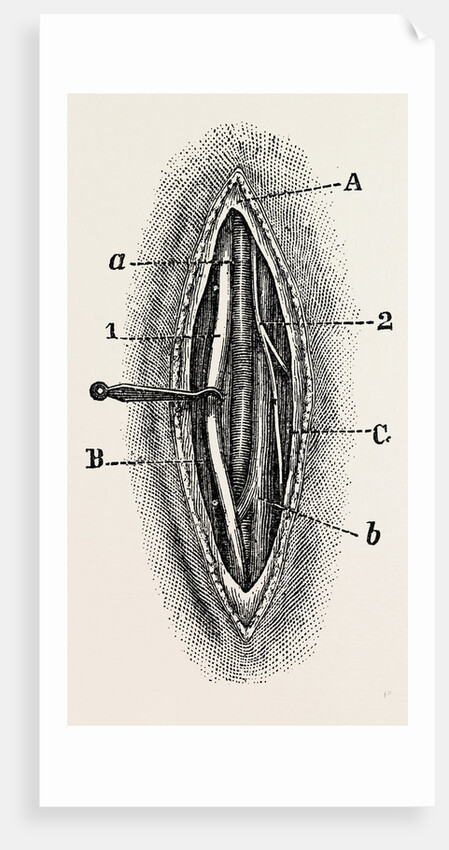 Ligature by Anonymous