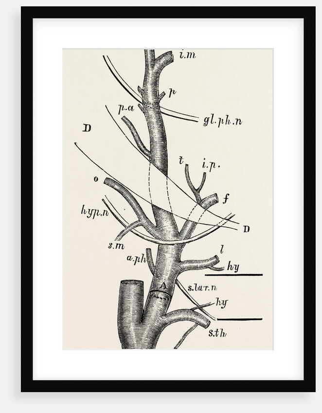 External carotid artery; natural size by Anonymous