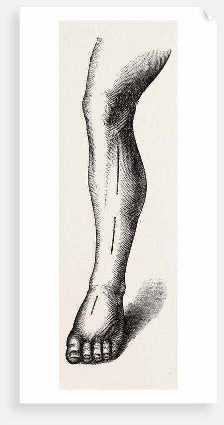 Ligature by Anonymous