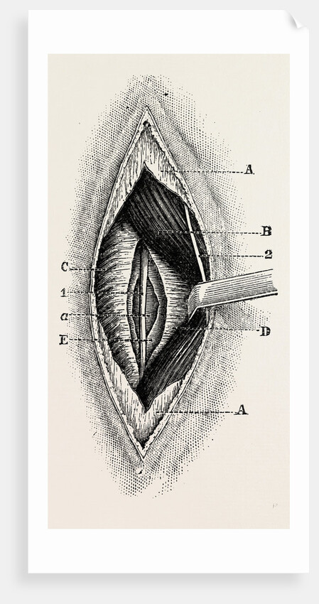 Ligature by Anonymous