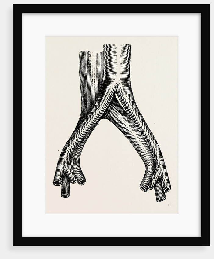 Relation of veins by Anonymous
