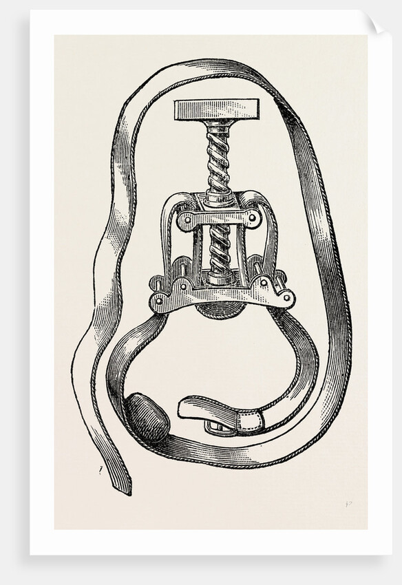 Petit's screw by Anonymous