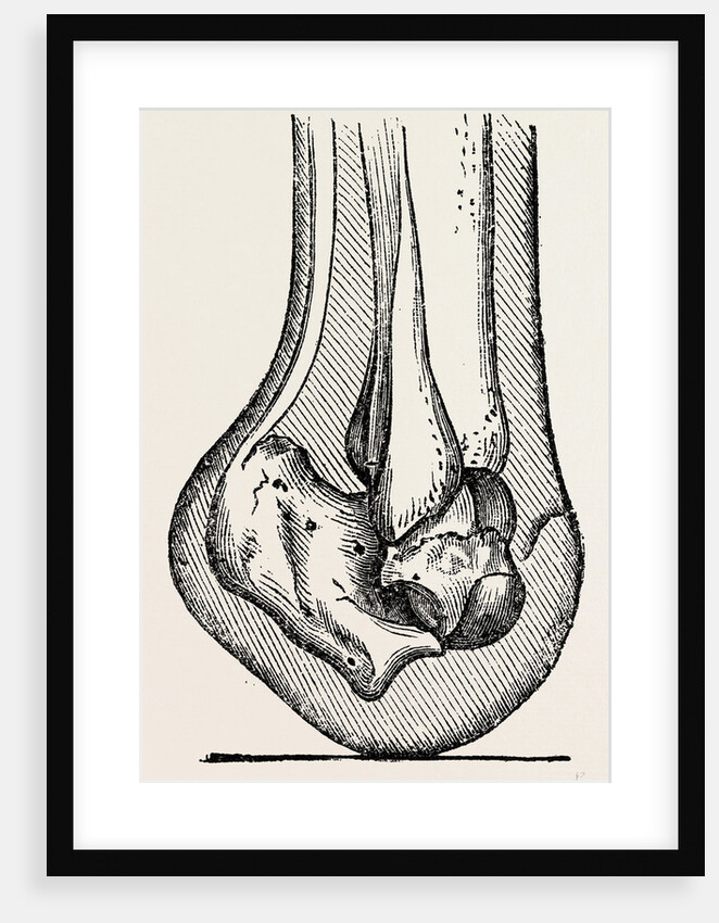 Anatomy by Anonymous
