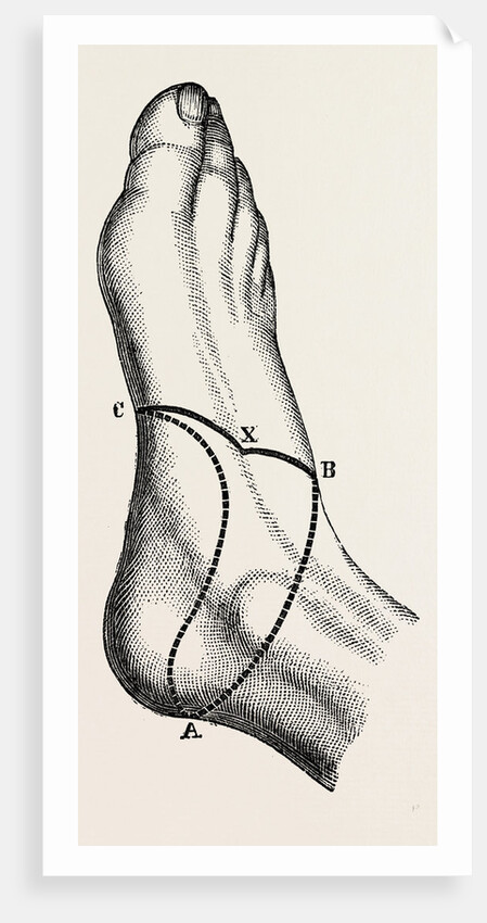 Inner and outer sides of the right foot by Anonymous