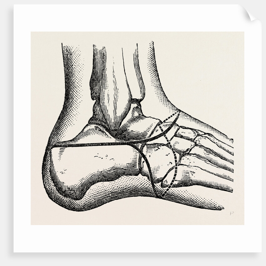 Pasquier by Anonymous