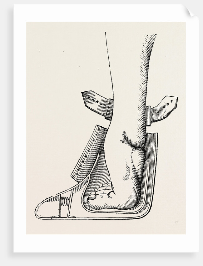 Aspect of limb by Anonymous