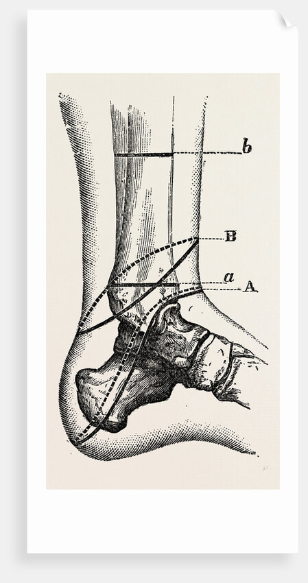 Guyon's by Anonymous