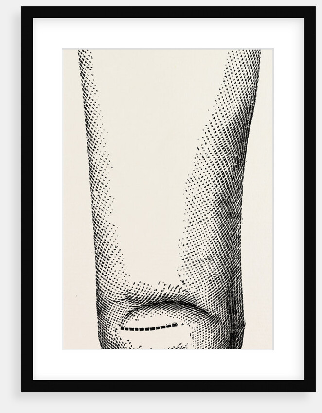 Stump by Anonymous