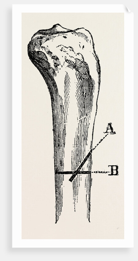 Method of method of sawing by Anonymous