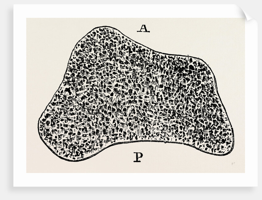 Transverse section by Anonymous