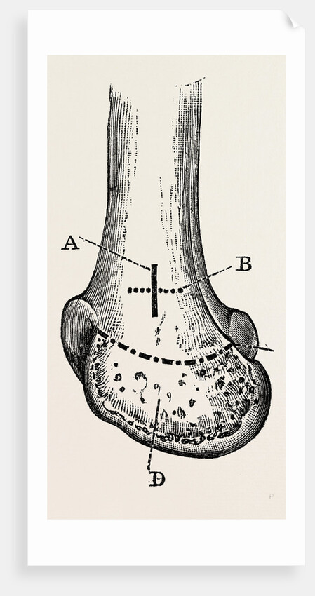 Macewen by Anonymous