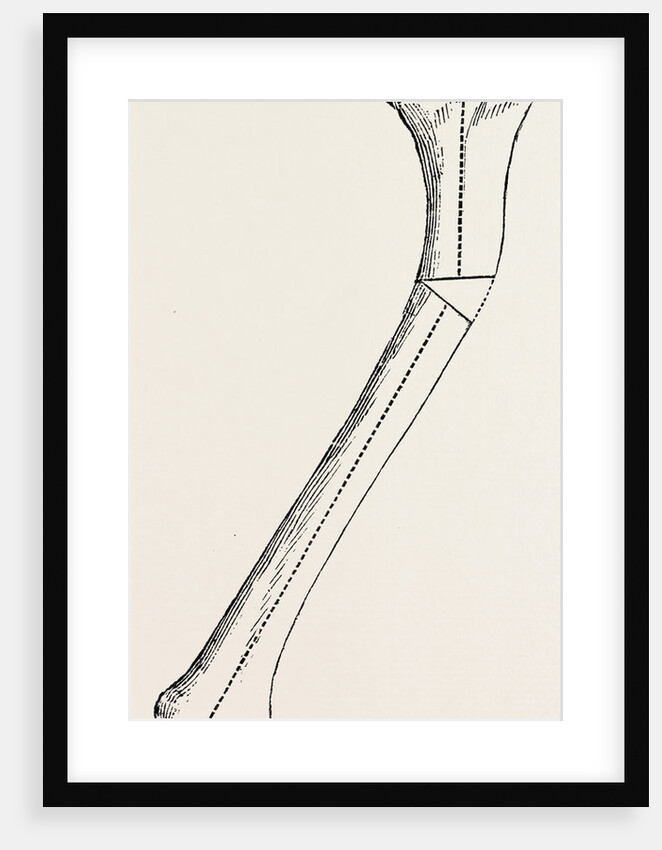 Bone by Anonymous