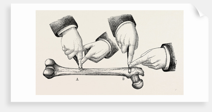 The method of using the rugine by Anonymous