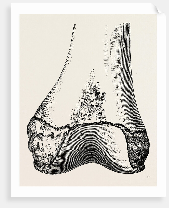 Epiphyses of the femur by Anonymous