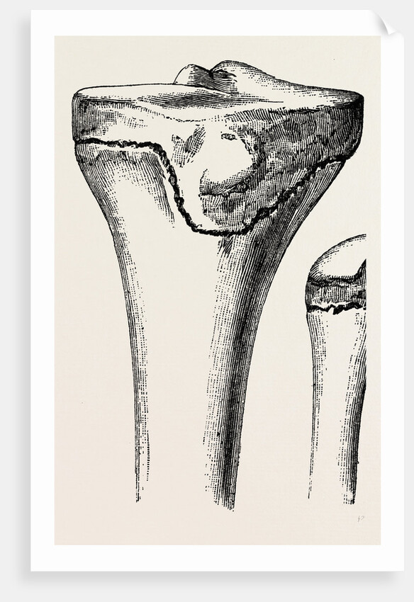 Epiphyses of the femur by Anonymous