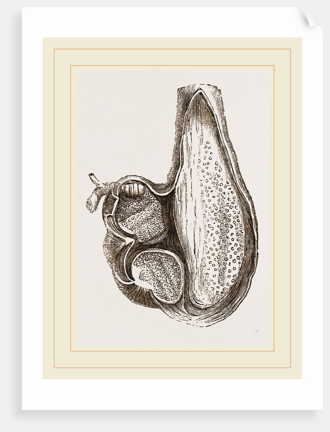 Stomach of Ostrich laid open by Anonymous