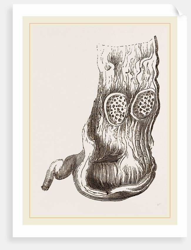 Stomach of Adjutant by Anonymous