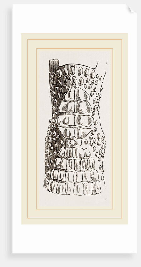 Cerviical Plates Jacare by Anonymous