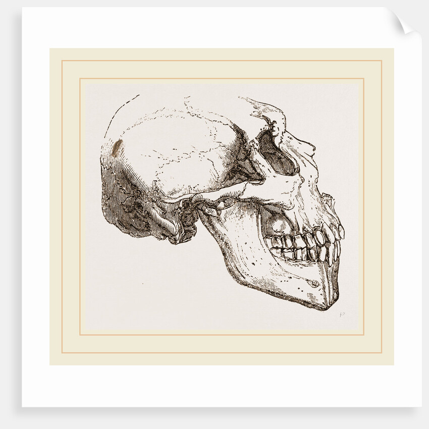 Skull of Human Idiot by Anonymous