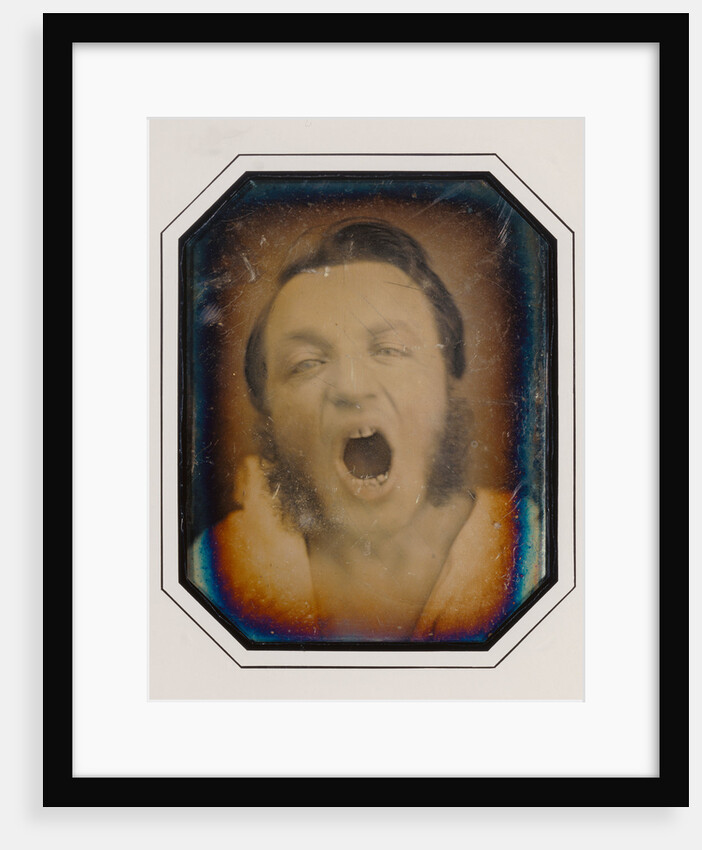 Man with Open Mouth by Anonymous