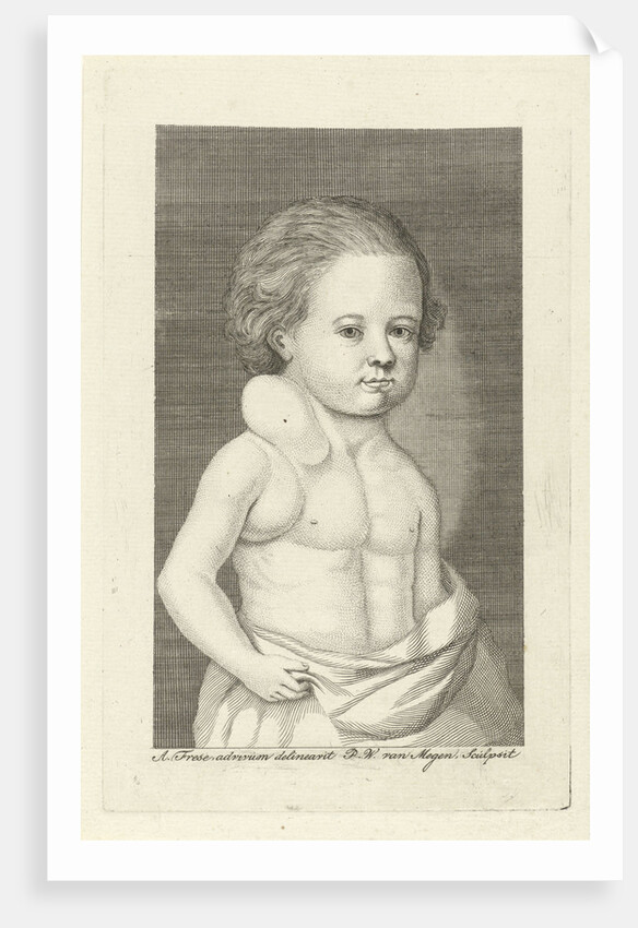 Boy with a tumor by Pieter Willem van Megen