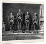 A Visit to the Battlefield of Solferino: Skeletons Found on the Battlefield by Anonymous