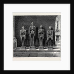 A Visit to the Battlefield of Solferino: Skeletons Found on the Battlefield by Anonymous