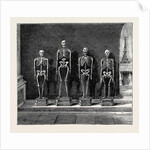 A Visit to the Battlefield of Solferino: Skeletons Found on the Battlefield by Anonymous