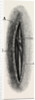 Ligature by Anonymous