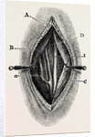 Ligature by Anonymous