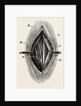 Ligature by Anonymous